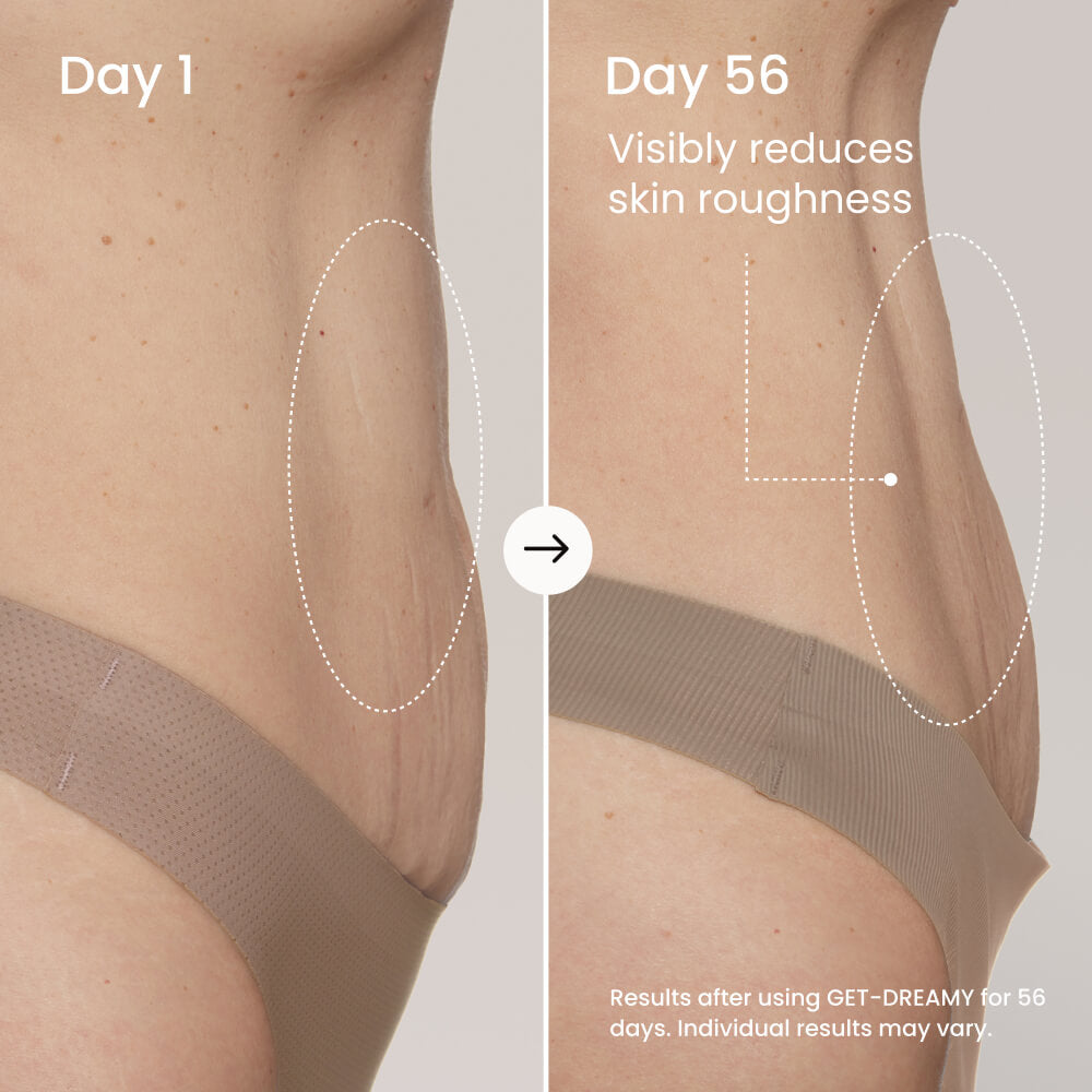 MAËLYS GET-DREAMY Overnight Toning Body Whip